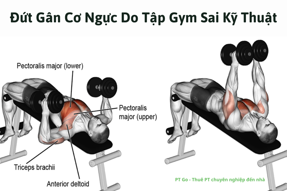 Đứt Gân Cơ Ngực Do Tập Gym Sai Kỹ Thuật